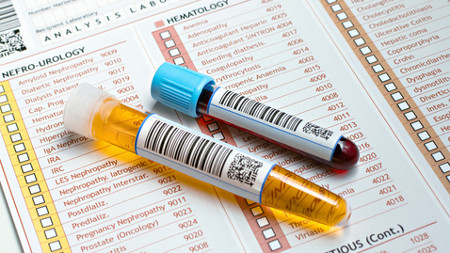 Blood in Urine Test